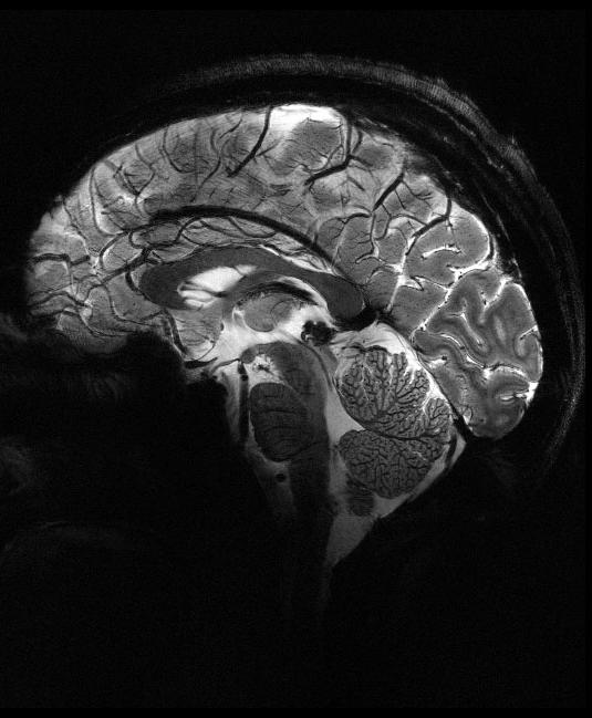 human brain