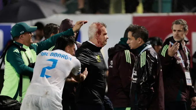 Mexico's national soccer team manager Javier Aguirre tends to his bleeding head after being struck by a can thrown from the stands. Jorge Salvad/ Getty image