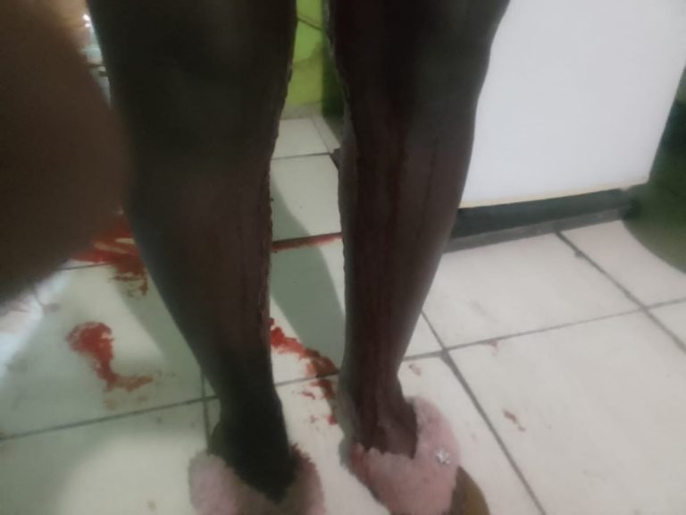 15-year-old raped