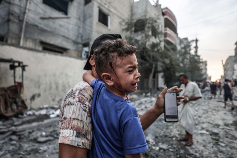 UN Committee calls for urgent humanitarian aid as children in Gaza are left injured and disabled
