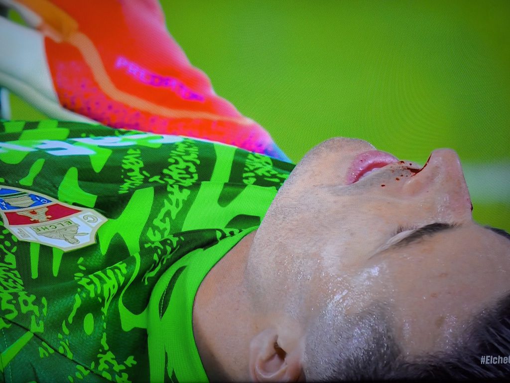 Elche goalie after being kicked.