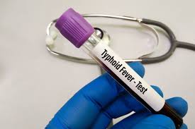 Tshwane water ruled out in typhoid outbreak